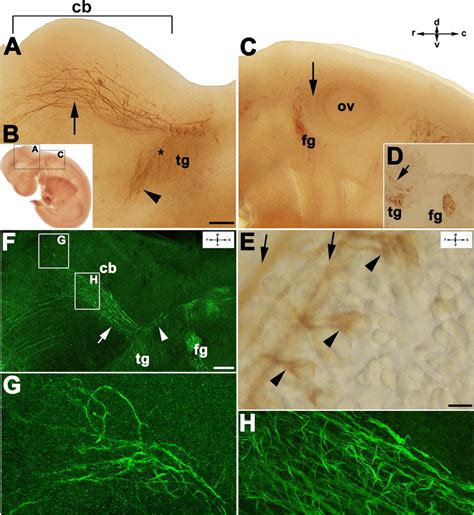 The Cranial Nerves In The Whole Mount Mouse Embryo At E9 Immunostained