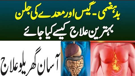 Pait Ki Gas Ka Ilaj How To Avoid Stomach Gas Problems Acidity