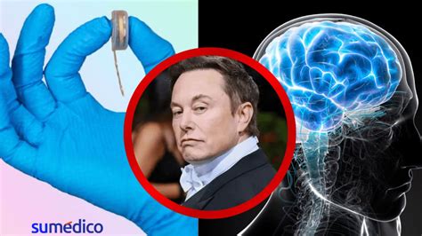 Elon Musk Busca Implantar Chip Cerebral Para Curar Enfermedades Logr