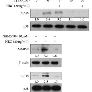 Schematic Models Depicting The Effects Of Pterostilbene On