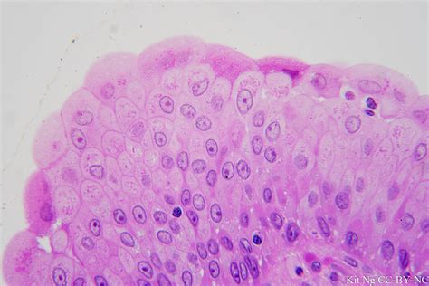 Transitional Epithelium Microscope