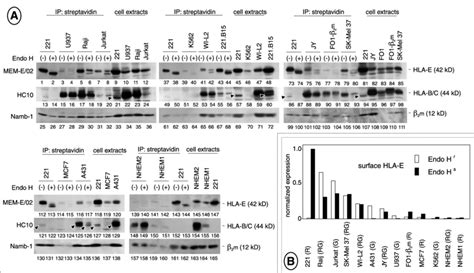 Hla E Expression On The Tumor Cell Surface A Np40 Extracts 1 Mg