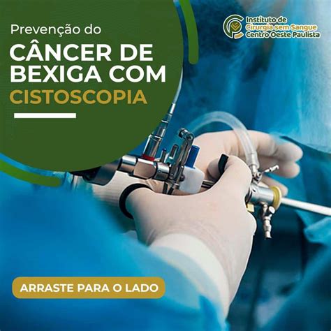 Prevenção do câncer de bexiga cistoscopia Instituto Cirurgia Sem