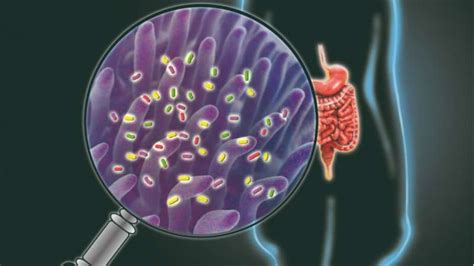 Probiotics Or Prebiotics Exploring The Complex World Of Gut Health