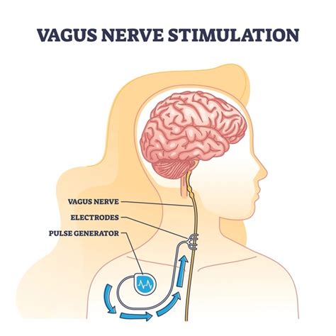 Diagram Stimulate Vagus Nerve Royalty Free Images Stock Photos