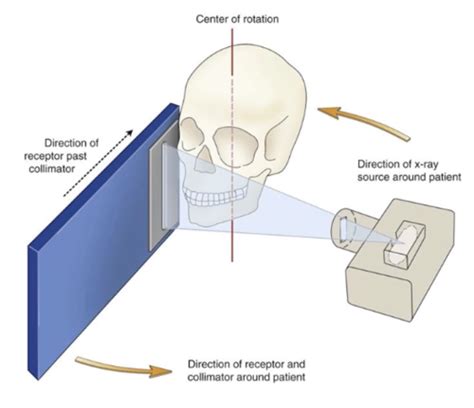 Panoramic Radiographs Anatomy And Basic Interpretation Flashcards Quizlet