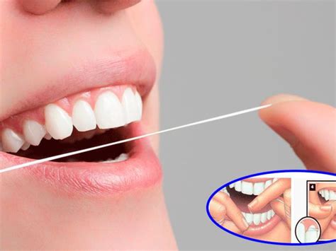 Consejos Para Utilizar Correctamente El Hilo Dental Gemeldent