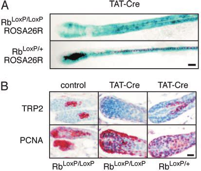 Tat Cre Mediated Inactivation Of Rb Results In Depletion Of