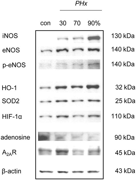 eNOS iNOS p eNOS HO 1 SOD2 HIF 1α adenosine and A2AR