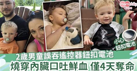 【意外】2歲男童誤吞遙控器鈕扣電池 燒穿內臟僅4天奪命