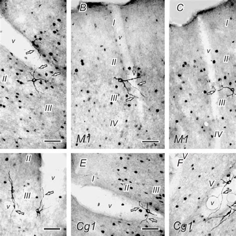 Photomicrographs Of Fos Immunoreactive Neurons And Nadph Diaphorase