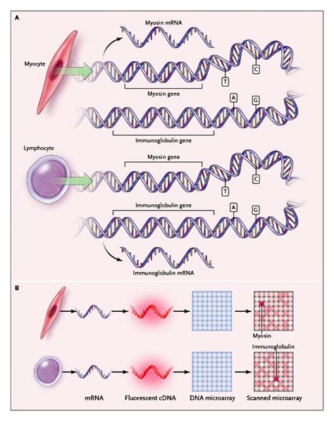 Molecular Diagnosis Of The Hematologic Cancers New England Journal Of