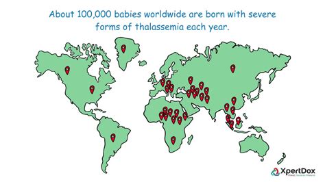 Thalassemia Origin Thalassemia Beta Thalassemia Major Causes