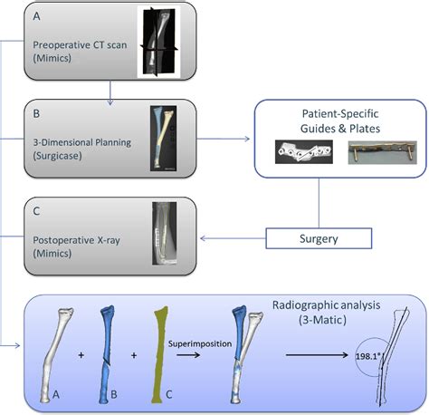 Figure 3 From Corrective Osteotomy For Malunited Diaphyseal Forearm Fractures Using Preoperative