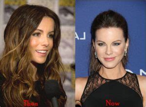 Kate Beckinsale Nose Job Plastic Surgery Before And After Photos