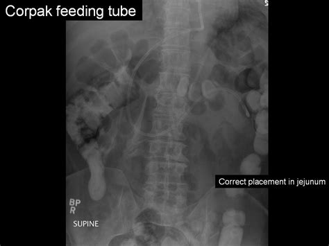 On Call Radiology Common Radiology Findings On Call And In The