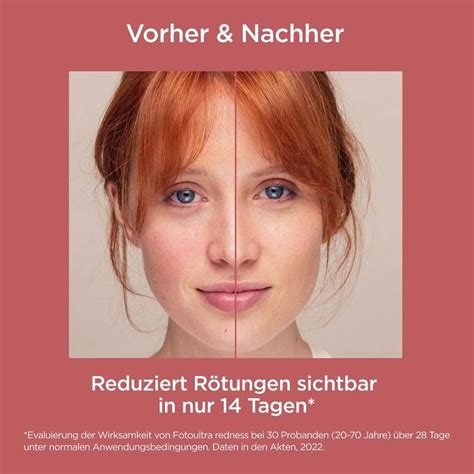 Isdin Fotoultra Redness Sonnencreme Gesicht Lsf Bei Sehr