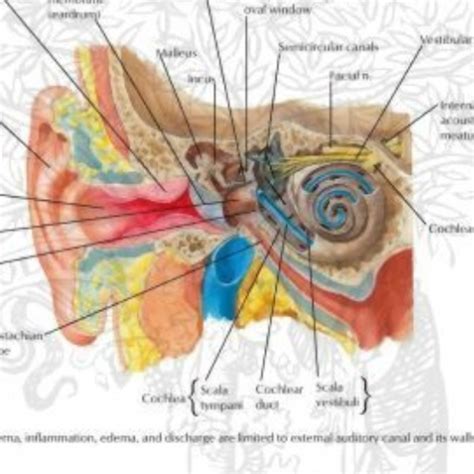 OTITIS EXTERNA OÍDO DEL NADADOR