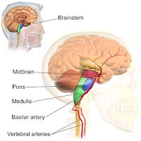 Walter's Hydrocephalus Education blog: Complications and malfunctions of shunt systems