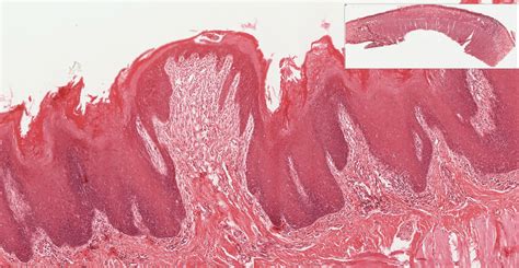 Oral Cavity and Salivary Glands | histology