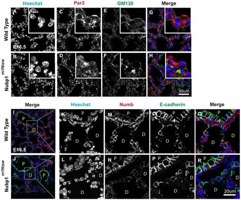 Nubp M Nisw Lungs Show Altered Distribution Of Par And Numb A R