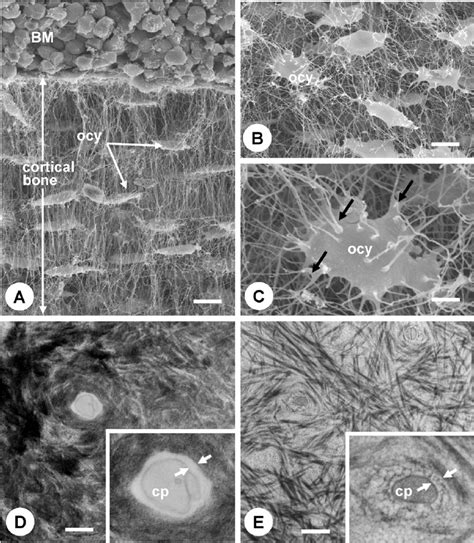 Osteocyte Cell Microscopic