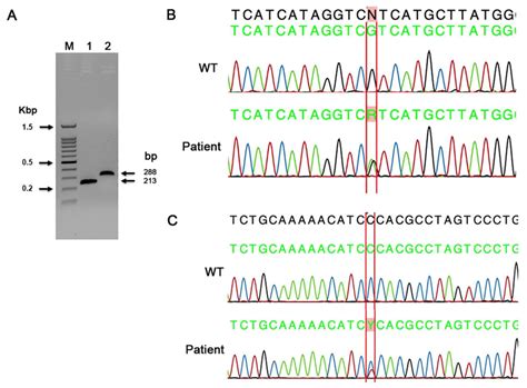 A Representative PCR Gel And Electropherograms For IDH1 And IDH2