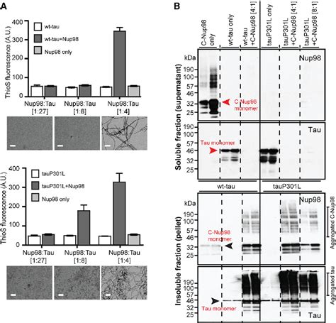 Figure From Tau Protein Disrupts Nucleocytoplasmic Transport In