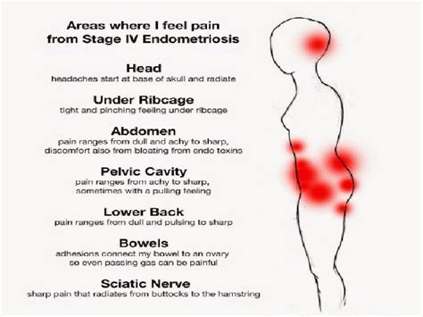 Endometriosis Easy Explanation With Management