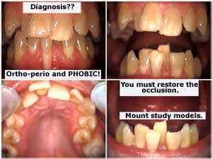 Mucogingival Involvement And Attached Gingiva