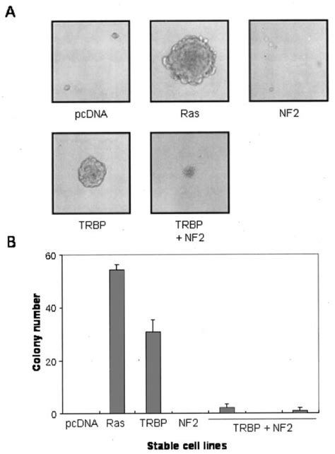 Merlin Suppresses TRBP Induced Anchorage Independent Cell Growth In