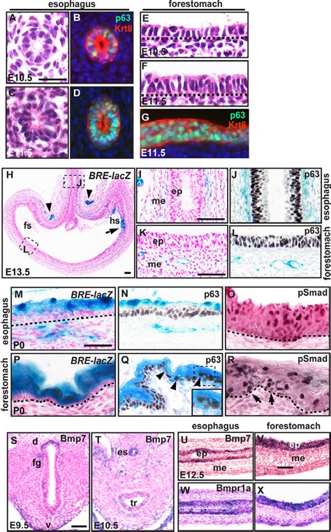 Figure From Bmp Signaling In The Development Of The Mouse Esophagus