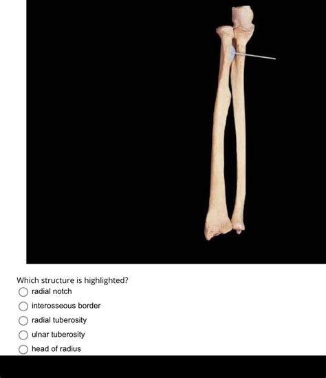 [ANSWERED] Which structure is highlighted radial notch interosseous - Kunduz