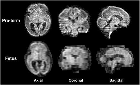 Frontiers Through Plane Super Resolution With Autoencoders In