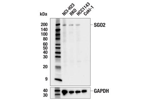 Sgo E K N Rabbit Mab Cell Signaling Technology