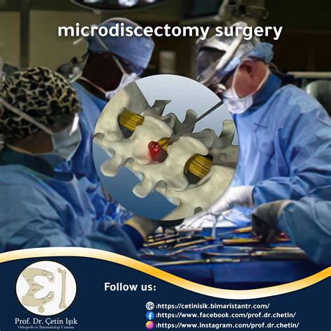 Microdisc Surgery To Treat Disc Herniation Dr Whats Wrong With You