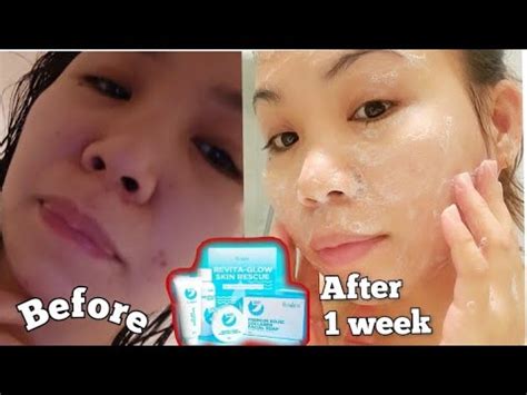 7 Days Using Her Skin Rejuvenating Set Experience Honest Review