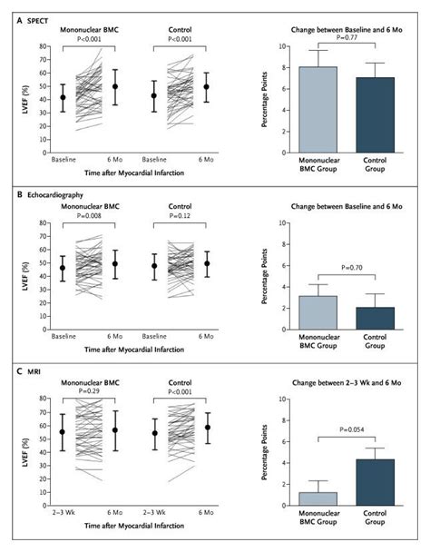 Intracoronary Injection Of Mononuclear Bone Marrow Cells In Acute