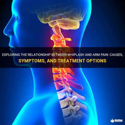 Exploring The Relationship Between Whiplash And Arm Pain Causes