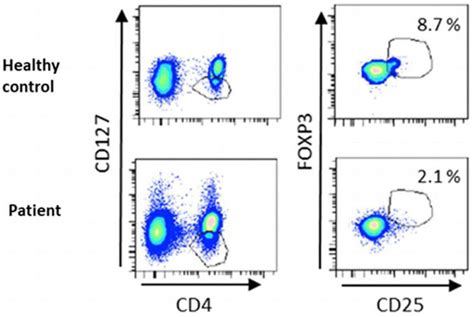 Flow Cytometric Approach In The Diagnosis Of Primary Immunodeficiencies