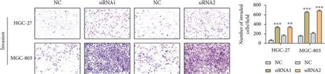 CDR1as Knockdown Promotes Migration And Invasion Of GC Cells A B