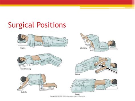 Surgical Positions Chart