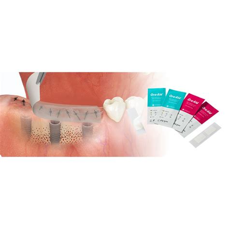 Ora-Aid pansament intraoral atasabil ? ⭐ La Marvel Distribution gasesti ...