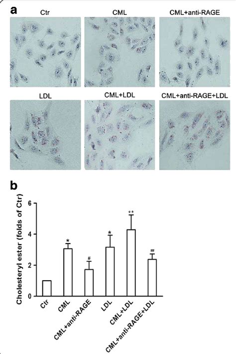 Visualization Of Ldl Uptake And Lipid Droplets In Human Renal Tubular