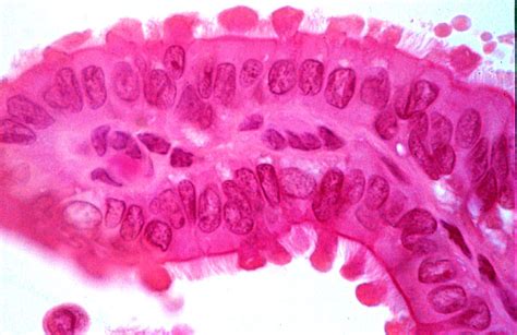 HLS [ Female Reproductive System, oviduct; ampulla, epithelium] HIGH MAG