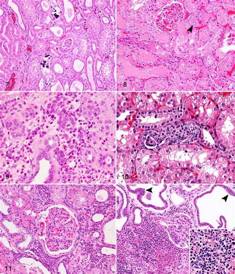 Chronic Progressive Nephropathy CPN Naked Mole Rat Kidney Figure