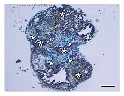 A Von Kossa Staining And Counterstaining With Methylene Blue Most