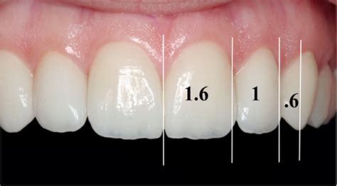 What Is The Golden Proportion Of Dentistry The Dawson Academy