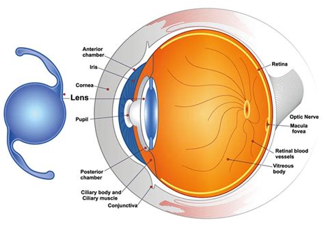 Innovation Eye Clinic Cataract Treatment And Surgery Innovation Eye