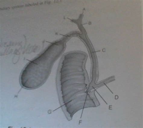 Chapter Biliary Tract And Upper Gastrointestinal System Flashcards